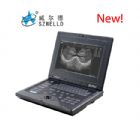 WED-2018筆記本全數(shù)字超聲診斷系統(tǒng)