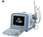 便攜超聲診斷系統(tǒng) TH-100