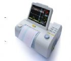 胎兒監(jiān)護(hù)儀 EMF9000 B